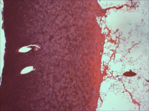 Thermal Burns and Dermatitis Modeling
