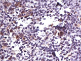 Stem Cell Immunohistochemistry Stem Cell Immunohistochemistry